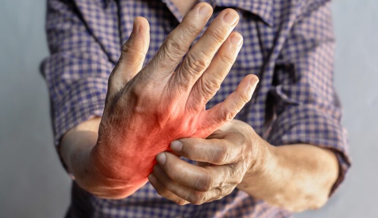 Rheumatoid Arthritis